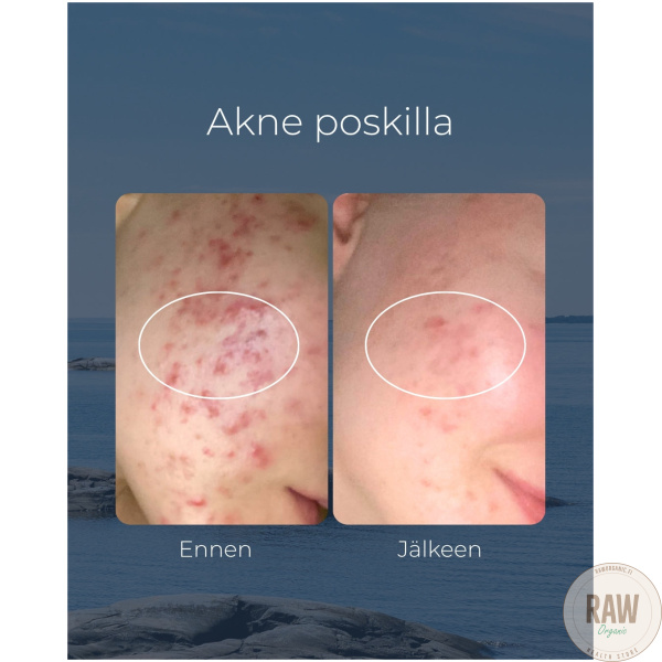 Saaren Taika Teepuusaippua, 90g – kuva 2