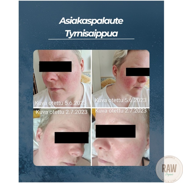 Saaren Taika Tyrni palasaippua, 90g – kuva 6