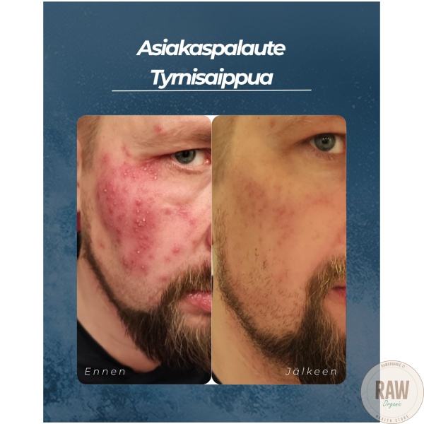 Saaren Taika Tyrni palasaippua, 90g – kuva 4